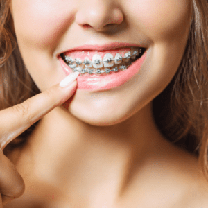 orthodontist in West Orange