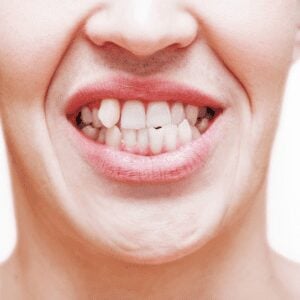 orthodontics in West Orange, NJ