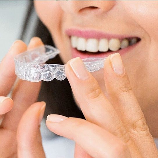 benefits of invisalign and clear aligners