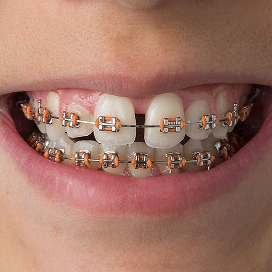 MyOrthodontist -