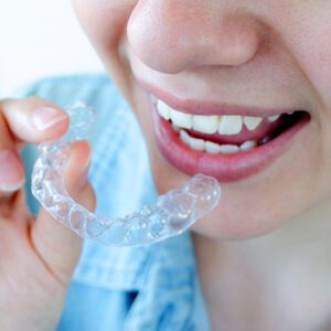 invisalign