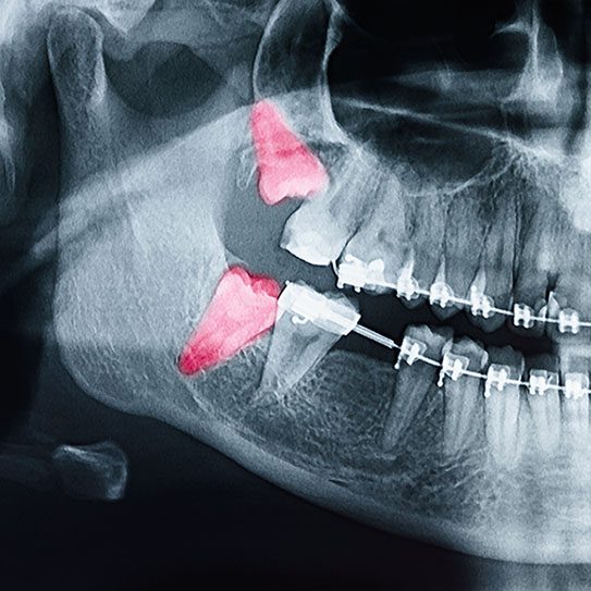 MyOrthodontist -