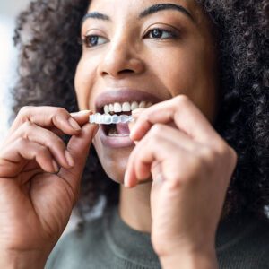 Invisalign affordable clear aligners orthodontist