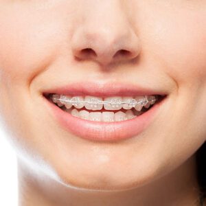 orthodontist near me adult braces orthodontist NJ
