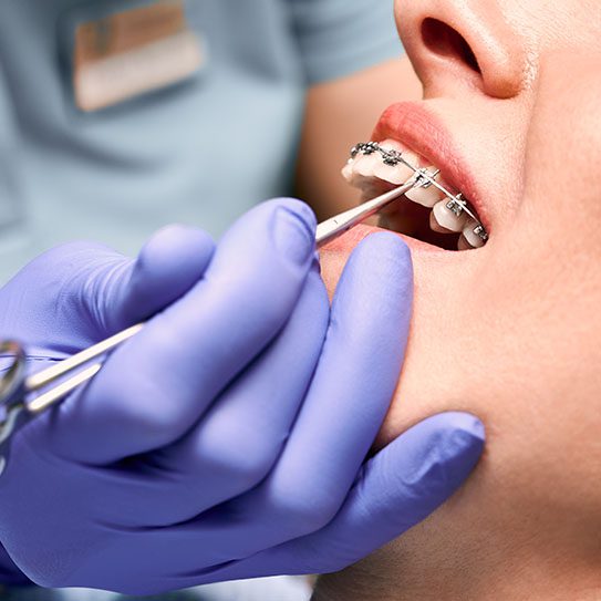 braces orthodontist near me NJ orthodontist