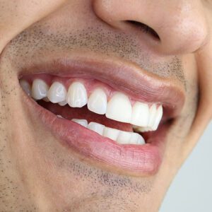 teeth whitening near me orthodontist