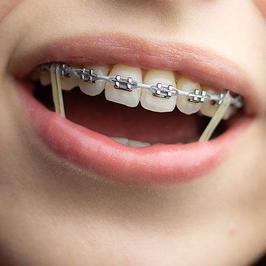 MyOrthodontist -