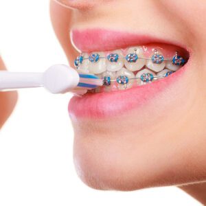 braces Lawrenceville orthodontist Invisalign