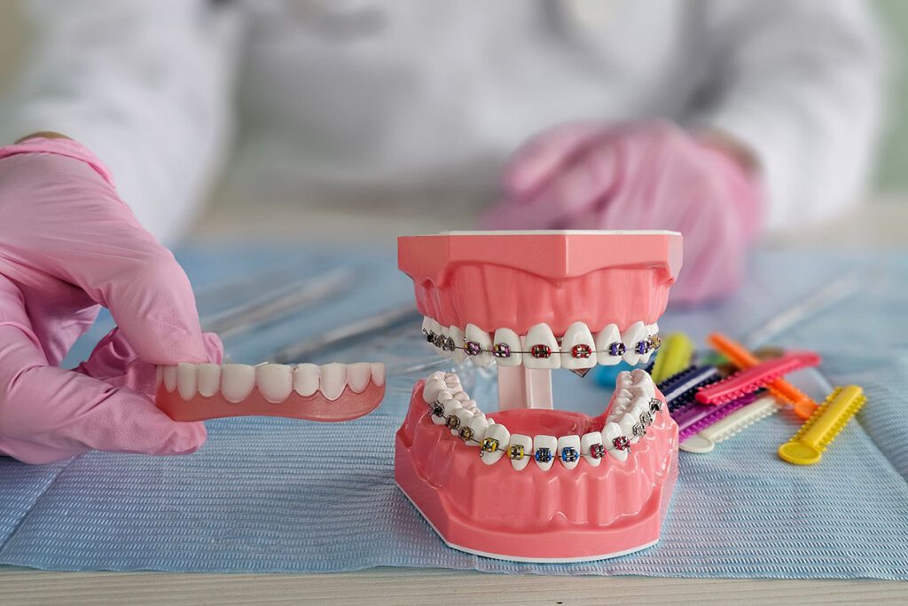 invisalign near me orthodontist deptford