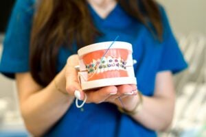 dental care braces