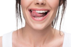 straighten teeth retention