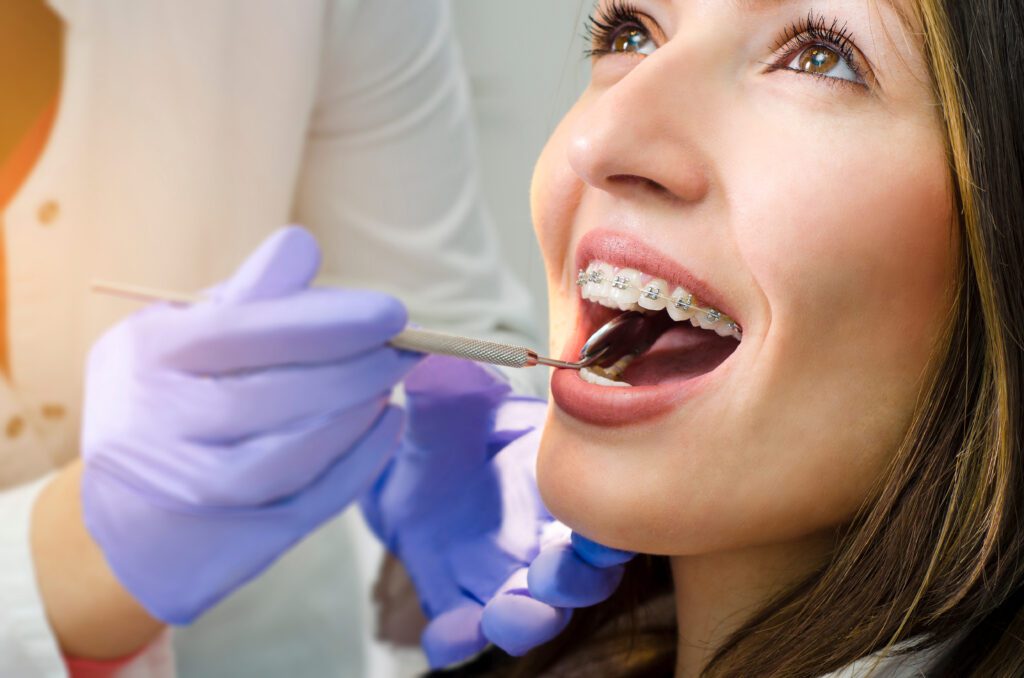 Are Adult Braces Noticeable? What Patients Should Expect - MyOrthodontist - adult braces in Lawrenceville