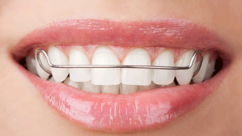Who Counts as a Braces Specialist? Orthodontists Vs. Dentists - MyOrthodontist - braces specialist in Deptford Township