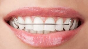 braces specialist in Deptford Township