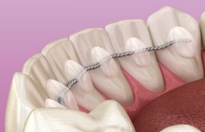 orthodontic treatment in West New York