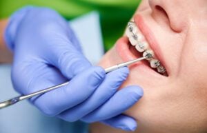 West Orange orthodontist