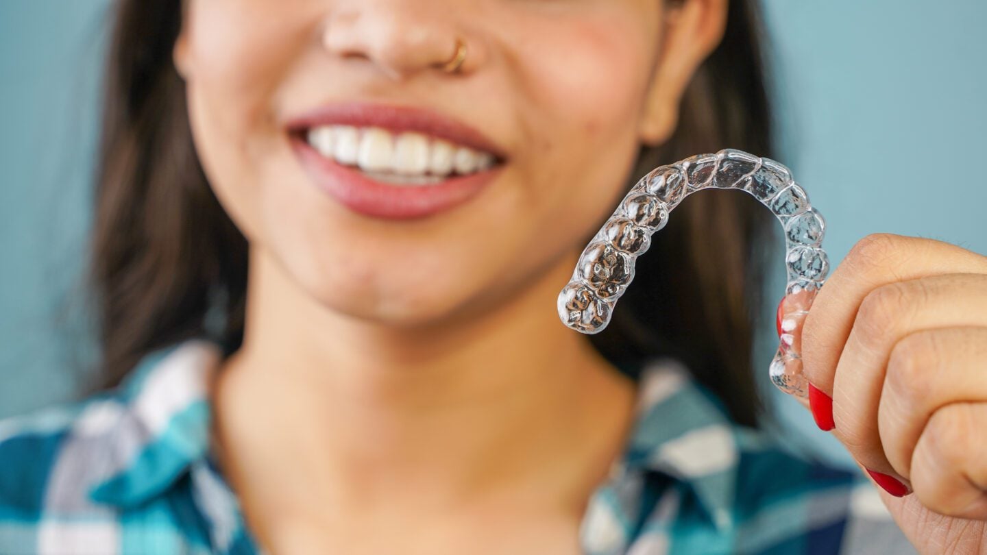 How Often Do You Change Invisalign Aligners? - MyOrthodontist - Invisalign aligners Invisalign aligners