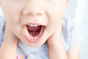 Orthodontics Blog - MyOrthodontist - early orthodontic treatment in Langhorne
